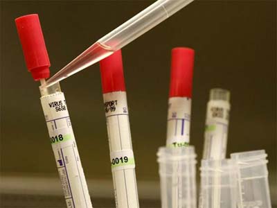 基因检测：：理想丰满 现实骨感